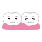 歯肉炎・腫れ・歯周病で不健康な歯茎のイラスト